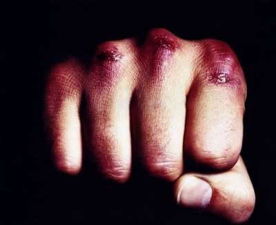 «Громкое» ограбление в Сумах: неизвестные напали на мастера спорта