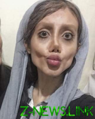 Девушка пережила множество операций ради внешности Джоли. Фото