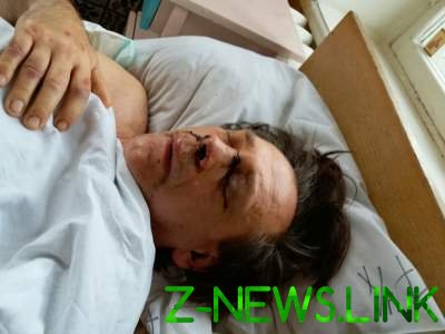 ЧП в Одессе: неизвестные зверски избили мужчину