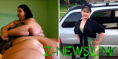 Самая толстая в мире женщина похудела на 400 кг. Фото